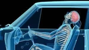 Herniated Disc From Car Accident